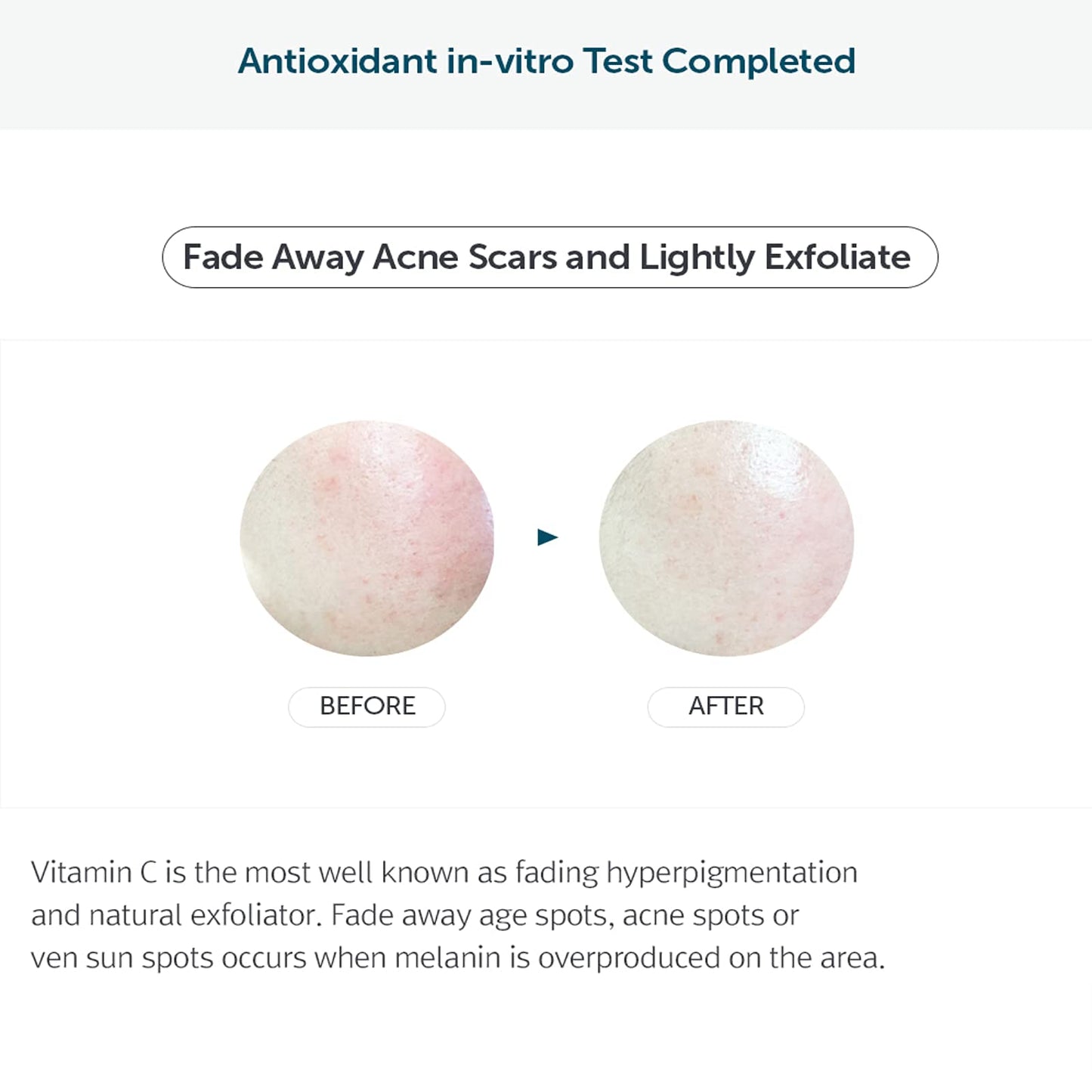 [DearKlairs] Freshly Juiced Vitamin Drop, 5% Hypoallergenic pure vitamin C serum, 35ml, 1.18oz | a potent skin rejuvenator, l ascorbic acid , antioxidant serum for face, korean skincare